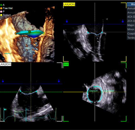 Echo Image